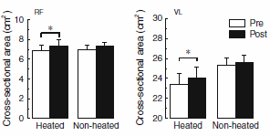 Spiergroei zonder training met anabole warmtetherapie