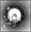 H5N1