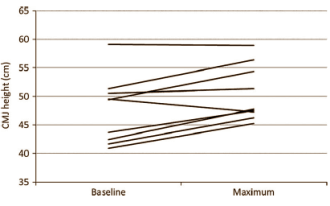 Studie: PAP-effect maximaal na 4-12 minuten