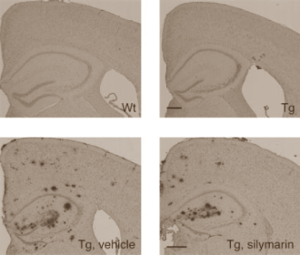 Dierstudie: Silybum marianum remt Alzheimer