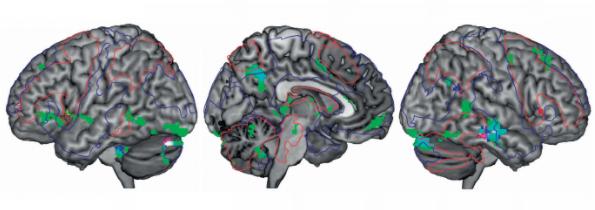 Voor iedereen met ADHD lijkt de studie, die neurologen van het Centre Hospitalier Universitaire in het Franse Nimes publiceerden in 2006, te mooi om waar te zijn. De onderzoekers konden de symptomen van ADHD in een groep kinderen fors verminderen - niet met een amfetamine-achtige stof, maar met een combinatie van magnesium en vitamine B6.