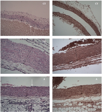 Aronia remt veroudering van hart en bloedvaten