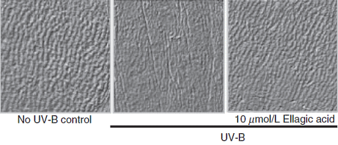 Ellaginezuur in bessen, frambozen en aardbeien blokkeert veroudering van de huid