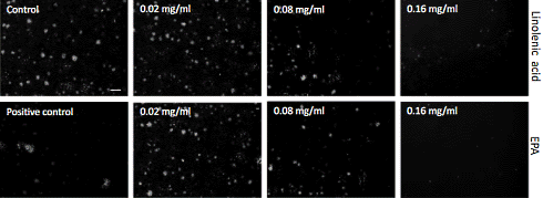 Houden omega-3-vetzuren het coronavirus buiten de deur?