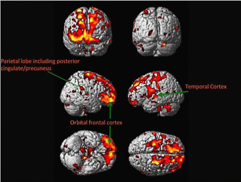 Viseter op leeftijd heeft betere hersenen