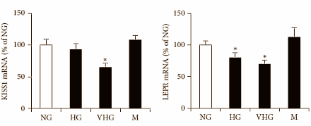Als er teveel glucose in je bloed circuleert, maakt je lichaam minder testosteron aan. Hoe dat precies kan, blijkt uit een in vitro-studie die Italiaanse endocrinologen, verbonden aan de universiteit van Florence, hebben gepubliceerd in de International Journal of Endocrinology. Wil je je testosteronspiegel op een natuurlijke manier verhogen? Zorg er dan voor dat je geen diabetes-2 krijgt, en voorkom absurd hoge glucosepieken.