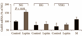 Als er teveel glucose in je bloed circuleert, maakt je lichaam minder testosteron aan. Hoe dat precies kan, blijkt uit een in vitro-studie die Italiaanse endocrinologen, verbonden aan de universiteit van Florence, hebben gepubliceerd in de International Journal of Endocrinology. Wil je je testosteronspiegel op een natuurlijke manier verhogen? Zorg er dan voor dat je geen diabetes-2 krijgt, en voorkom absurd hoge glucosepieken.