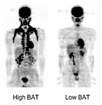 Meer bruin vet door twee koppen groene thee per dag