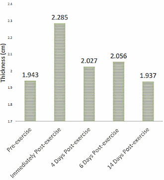 Rhabdomyolyse door high-reps-krachttraining