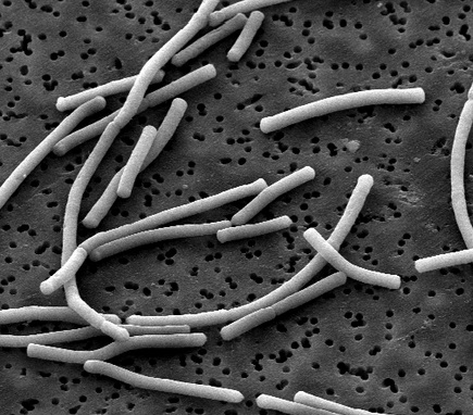 Geschiedenis probiotica begon met zoektocht naar levensverlenging