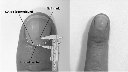 Een multivitamine voor je nagels