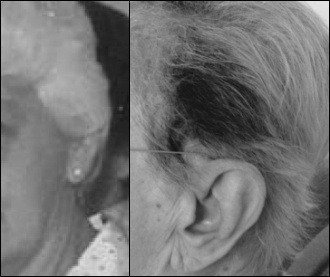 Gisteren schreven we dat para-aminobenzoic acid [PABA] in een dosis van enkele honderden milligrammen per dag volgens ietwat dubieuze studies uit de vorige eeuw grijs haar zijn oorspronkelijke kleur teruggeeft. Een ander supplement dat de vergrijzing van haar kan tegengaan is Mucuna pruriens, ontdekten twee Braziliaanse neurologen.