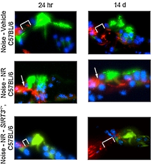 Dierstudie: nicotinamide-riboside beschermt je oren tegen lawaai