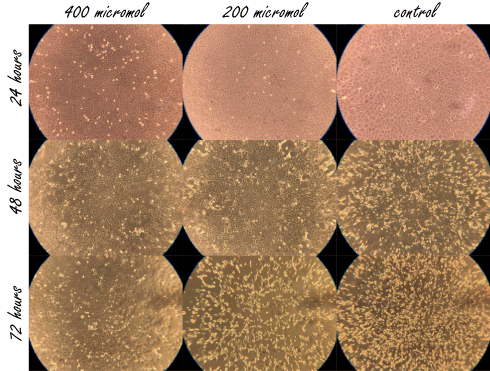 Remmen NO-boosters het coronavirus?