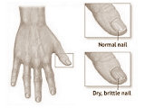 Biotine voor sterkere nagels