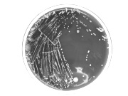 Bodybuilding, anabolen en de puistenbacterie