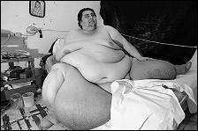 Manuel Uribe is 41 jaar en weegt 570 kilo. Dat is een record, goed voor een vermelding in het Guinness Book of Records. Tevens wil hij, na enige chirurgie, tweehonderd kilo afvallen - en ook dat wordt een record.