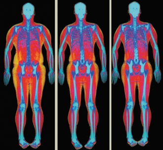 Meer choline en betaine in je voeding betekent meer spieren en minder vet