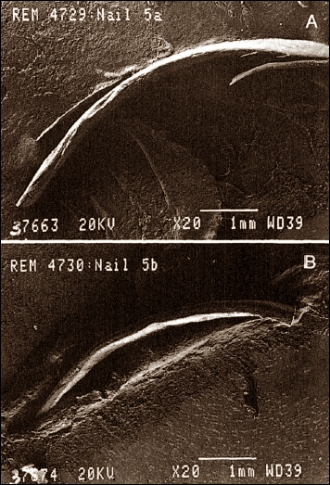 In elke drogist kun je biotinesupplementen kopen die broze nagels weer gezond moeten maken. Die dingen werken. De chemicus Erich Weirich bewees al in 1960 dat suppletie met de B-vitamine biotine nagels sneller laat groeien, en broze nagels weer sterk en gezond maakt.