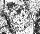 We weten niet of het ook kan gebeuren bij doses die humane chemische sporters gebruiken, maar wel dat het kan gebeuren bij de doses die de hormoonmaffia aan landbouwdieren geeft. Spaanse onderzoekers vonden het effect bij varkens, die drie maanden lang clenbuterol door hun voer hadden gekregen. Het spieropbouwende en vet-afbrekende middel had hun testes beschadigd.