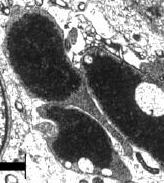 We weten niet of het ook kan gebeuren bij doses die humane chemische sporters gebruiken, maar wel dat het kan gebeuren bij de doses die de hormoonmaffia aan landbouwdieren geeft. Spaanse onderzoekers vonden het effect bij varkens, die drie maanden lang clenbuterol door hun voer hadden gekregen. Het spieropbouwende en vet-afbrekende middel had hun testes beschadigd.