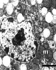 We weten niet of het ook kan gebeuren bij doses die humane chemische sporters gebruiken, maar wel dat het kan gebeuren bij de doses die de hormoonmaffia aan landbouwdieren geeft. Spaanse onderzoekers vonden het effect bij varkens, die drie maanden lang clenbuterol door hun voer hadden gekregen. Het spieropbouwende en vet-afbrekende middel had hun testes beschadigd.